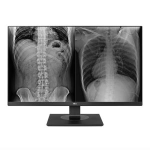 Monitor de Revisión Clínica LG 8MP 27” Negro