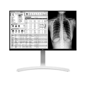 Monitor de Revisión Clínica LG 8MP 27” Blanco