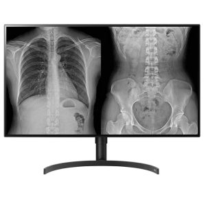 Monitor de Diagnóstico LG 8MP 31.5" para Radiología General