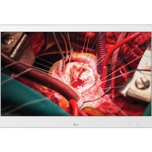 Monitor Quirúrgico LG FHD 27”