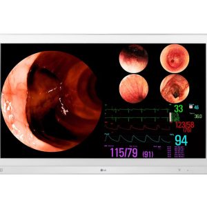 Monitor Quirúrgico LG 4K 31.5” IPS