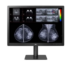 Monitor de Diagnóstico LG 12MP 31” para Radiología General y Mamografía