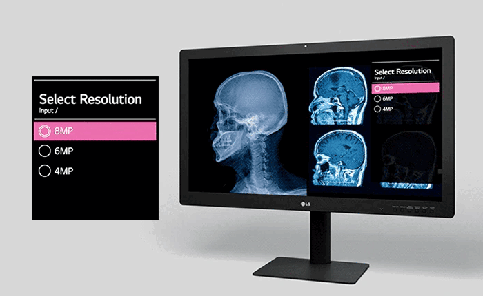 medical-32hq713d-03-1-multi-resolution-mode-d