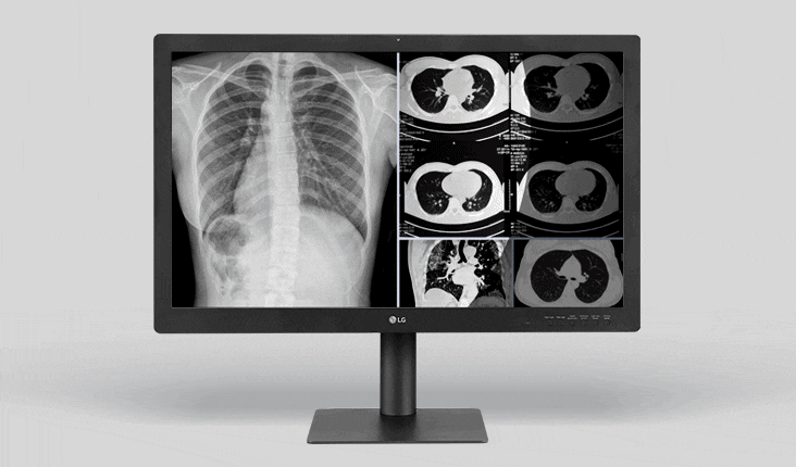 medical-32hq713d-06-1-focus-view-d