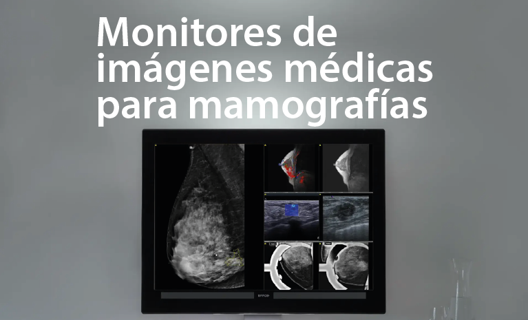 monitores mamog-02