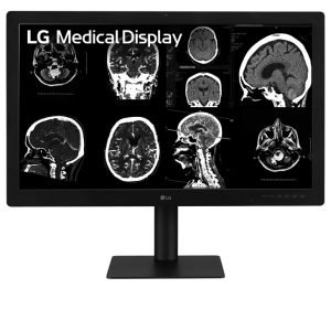 Monitor de Diagnóstico LG 8MP 31.5" para Radiología General y Mamografía