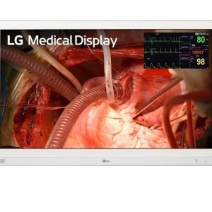 Monitor Quirúrgico LG 4K 27” MiniLED