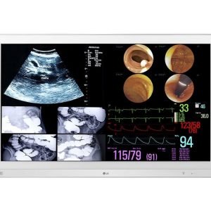 Monitor Quirúrgico LG 4K 31.5” (12G-SDI)